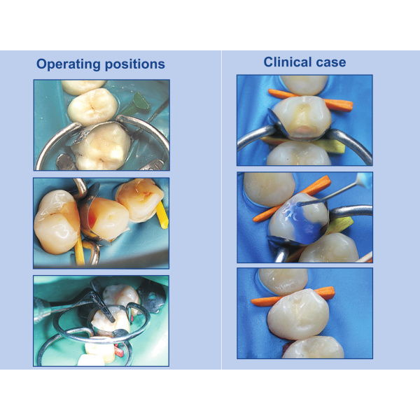 Kit Matrici Metalice Sectionale Conturate ASORTATE TOR VM 100buc/Kit