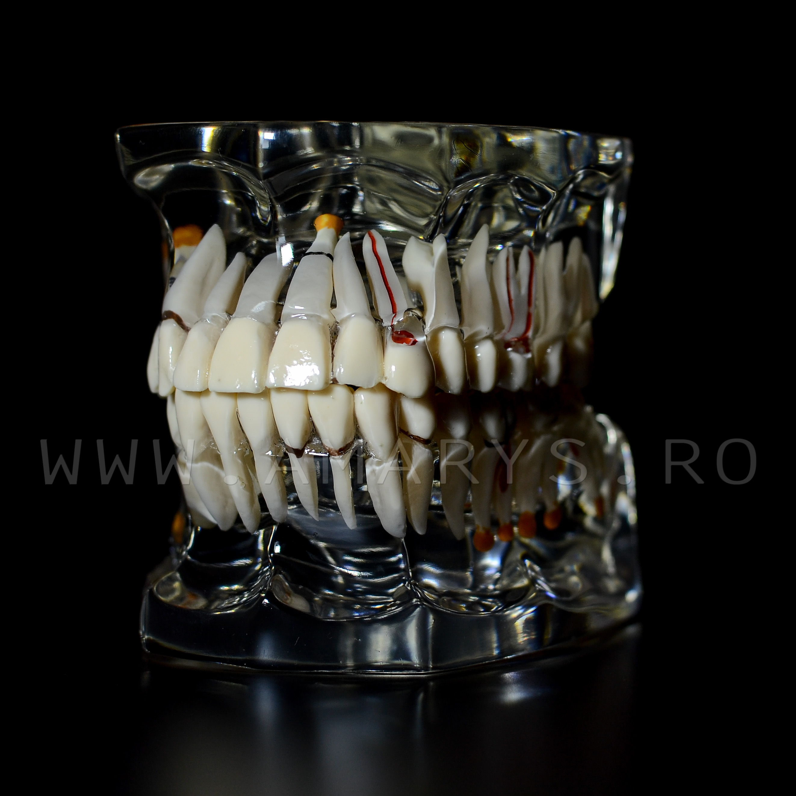 Arcada dentara patologie implant - endo - cario