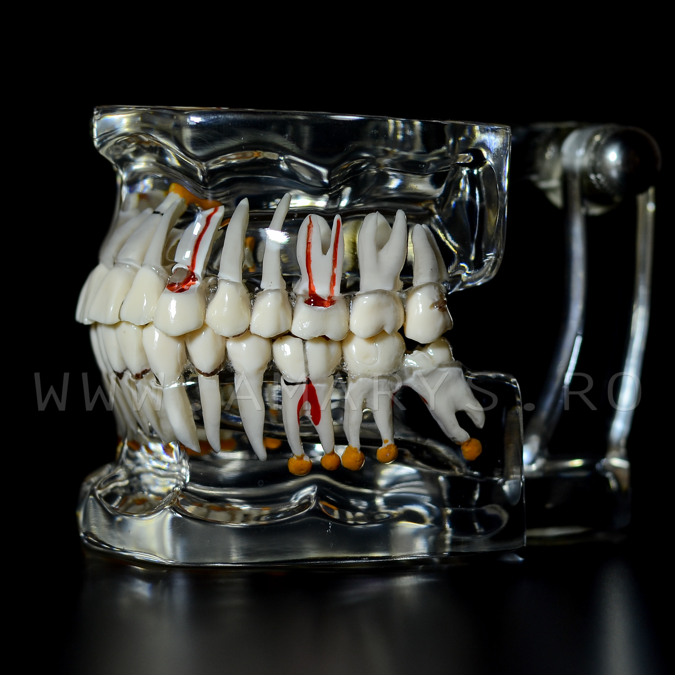 Arcada dentara patologie implant - endo - cario