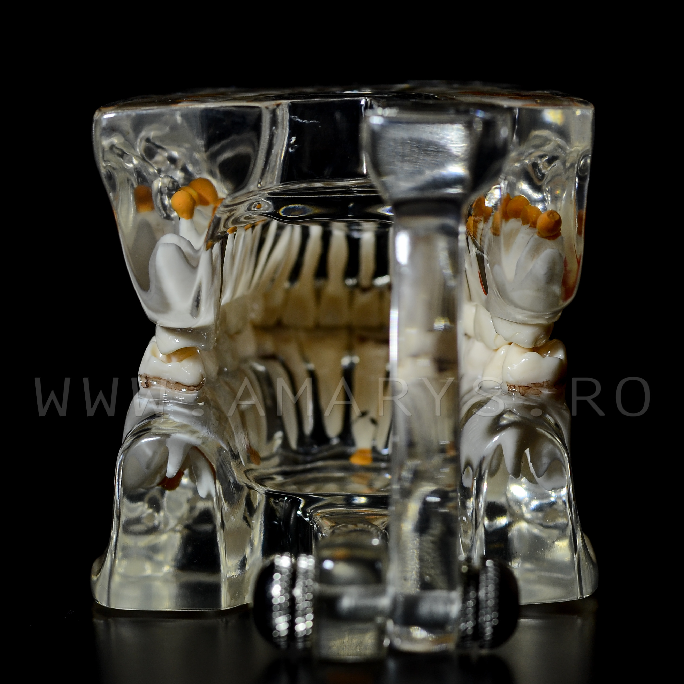 Arcada dentara patologie implant - endo - cario