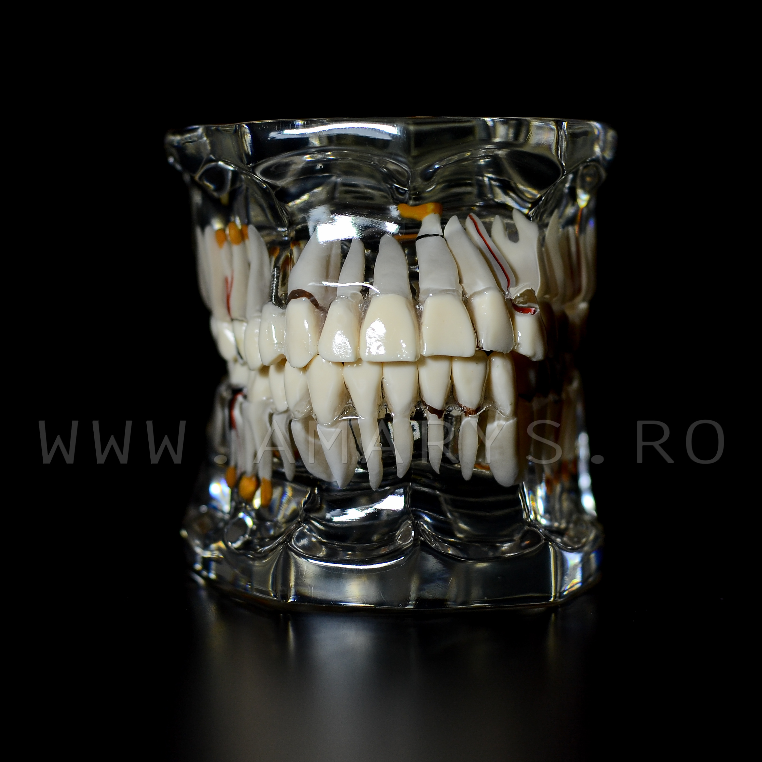 Arcada dentara patologie implant - endo - cario