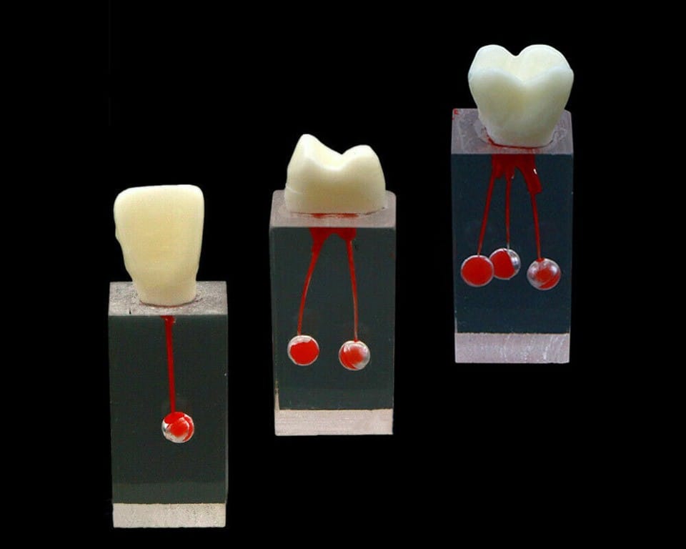 endo-block-n3