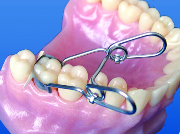 Matrici Metalice Saddle Conturate Standard MICI TOR VM 12buc/set