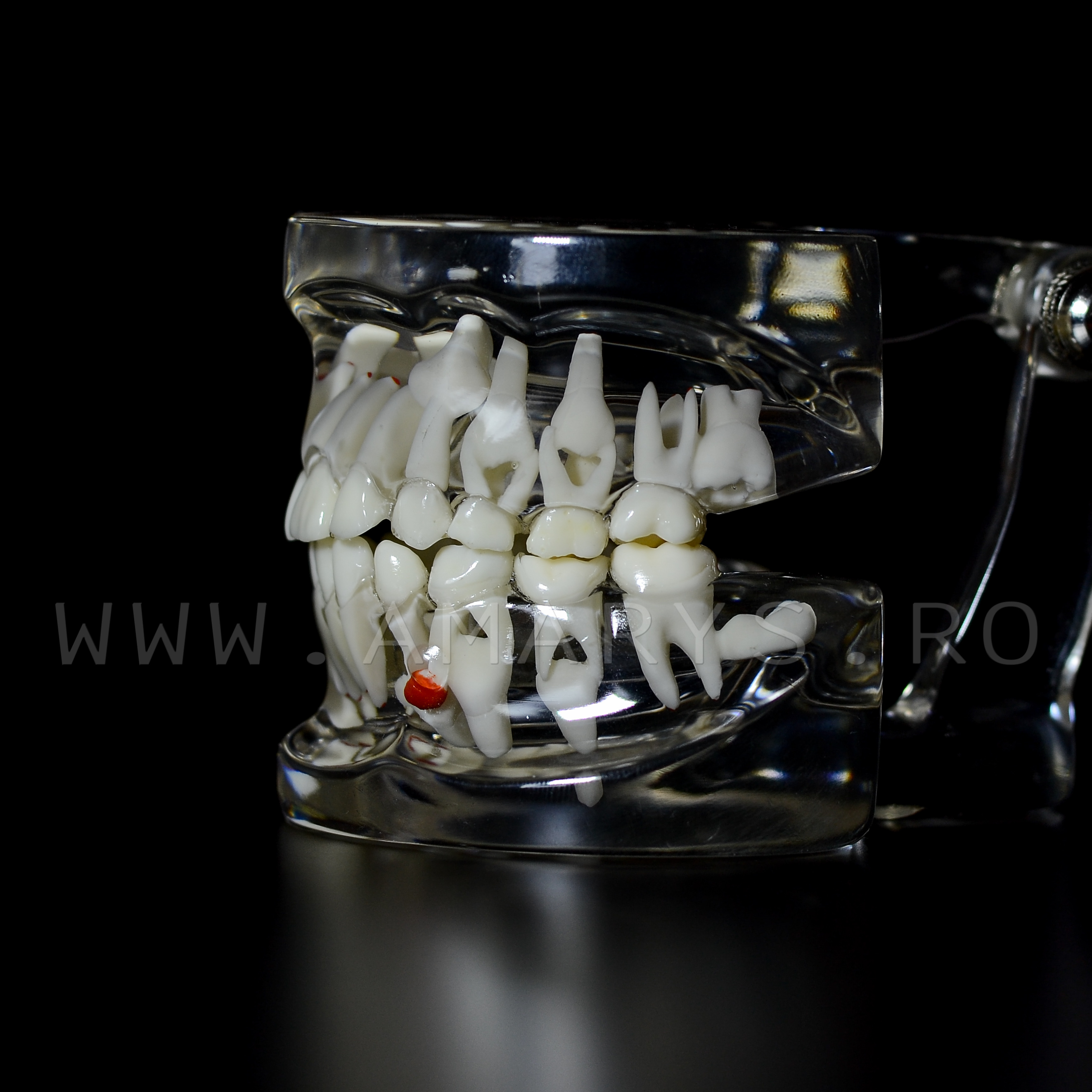 Arcada dentara patologie dentitie mixta