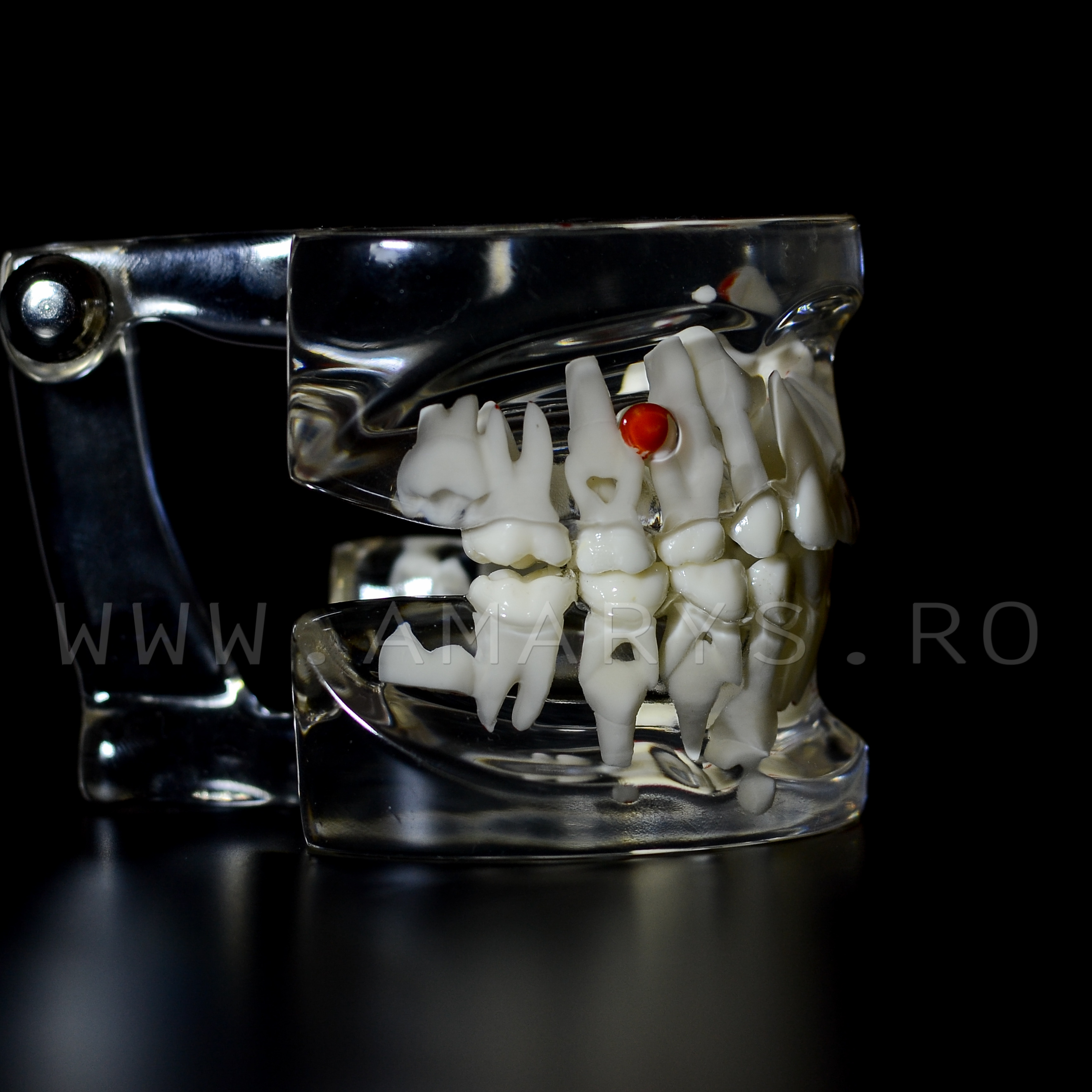 Arcada dentara patologie dentitie mixta