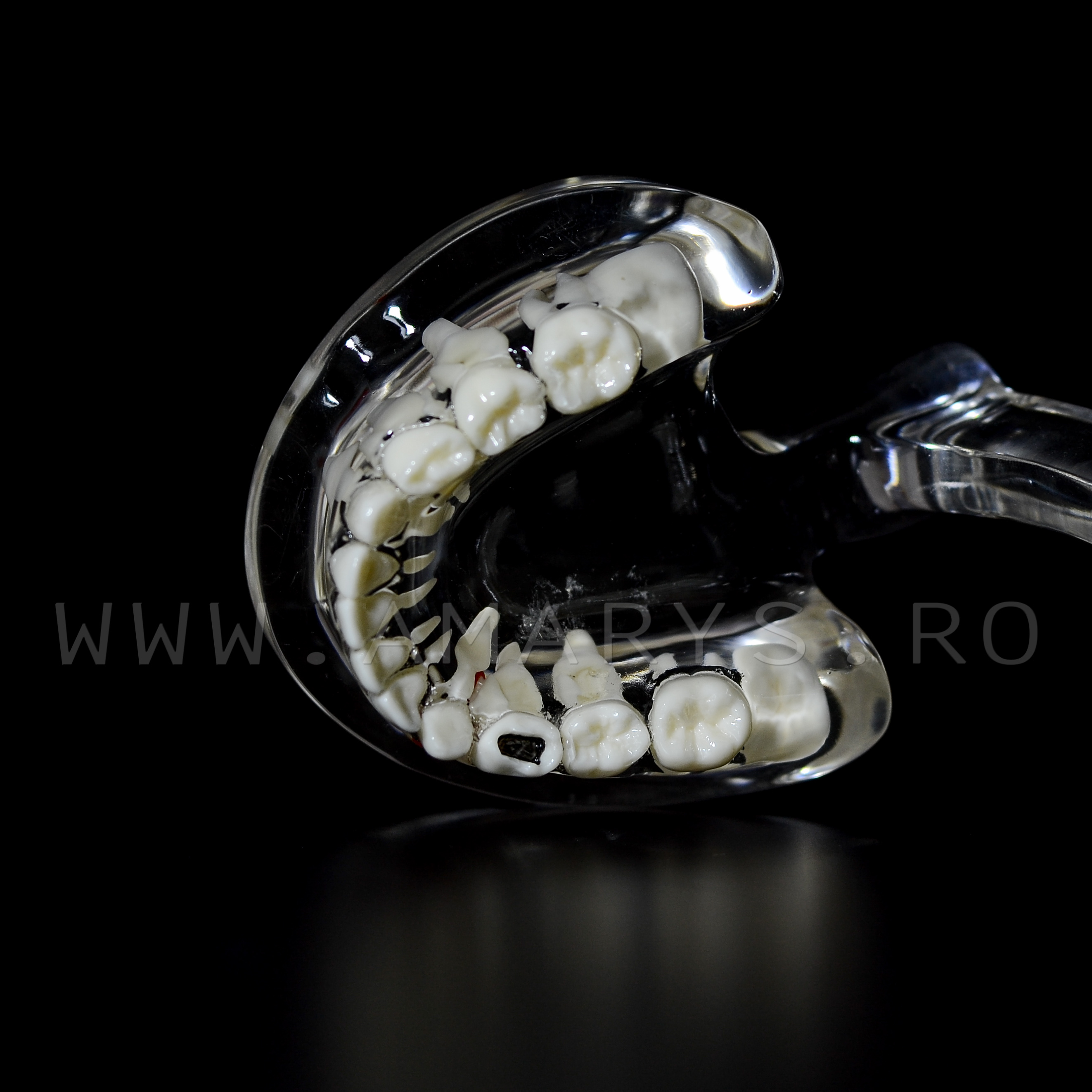 Arcada dentara patologie dentitie mixta