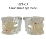 Arcada dentara patologie dentitie mixta