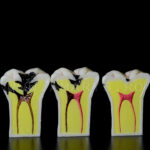 Model 3 dinti mariti cu evolutie carioasa Clasa 1 si 5 Black +endo