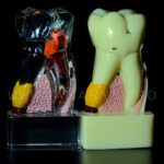 Dinte demonstrativ MOLAR transparent C17-01