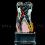 Dinte demonstrativ MOLAR transparent C17-01